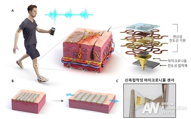 신축 접착성 마이크로니들 센서 (출처 : KAIST)